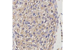 Immunohistochemistry (IHC) image for anti-ATP-Binding Cassette, Sub-Family A (ABC1), Member 6 (ABCA6) antibody (ABIN1870712) (ABCA6 anticorps)