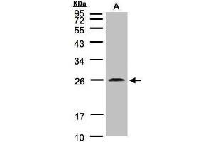 WB Image Sample(30 μg of whole cell lysate) A:MOLT4, 12% SDS PAGE antibody diluted at 1:2000