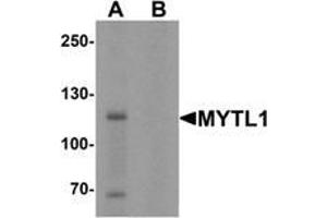 Western blot analysis of MYT1L in mouse brain tissue lysate with MYT1L Antibody  at 1 μg/mL in (A) the absence and (B) the presence of blocking peptide.