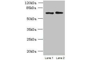 Western blot All lanes: TBC1D19 antibody at 9 μg/mL Lane 1: U251 whole cell lysate Lane 2: A375 whole cell lysate Secondary Goat polyclonal to rabbit IgG at 1/10000 dilution Predicted band size: 61, 53 kDa Observed band size: 61 kDa (TBC1D19 anticorps  (AA 1-300))
