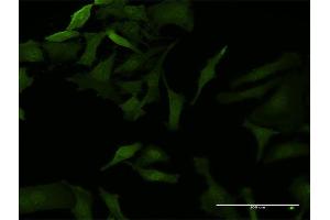 Immunofluorescence of monoclonal antibody to NFKBIB on HeLa cell.