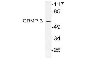 Western blot (WB) analysis of CRMP-3 antibody in extracts from HT-29 cells. (DPYSL4 anticorps)
