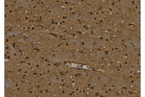 ABIN6277092 at 1/100 staining Rat brain tissue by IHC-P.