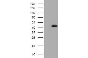HEK293T cells were transfected with the pCMV6-ENTRY control (Left lane) or pCMV6-ENTRY HIBCH (Right lane) cDNA for 48 hrs and lysed. (HIBCH anticorps)