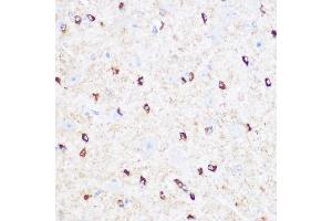 Immunohistochemistry of paraffin-embedded Mouse brain using CD47 antibody (ABIN6127604, ABIN6138199, ABIN6138201 and ABIN6223104) at dilution of 1:100 (40x lens). (CD47 anticorps  (AA 20-140))