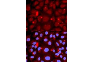 Immunofluorescence analysis of U2OS cells using PADI4 antibody (ABIN5970978). (PAD4 anticorps)