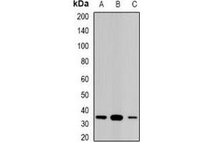 Western blot analysis of STAR expression in Jurkat (A), PC12 (B), mouse kidney (C) whole cell lysates. (STAR anticorps)