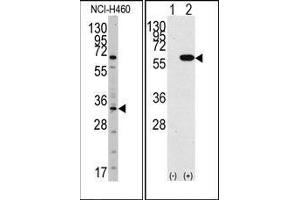 (LEFT)Western blot analysis of anti-YBX1 Antibody (N-term) in NCI-H460 cell line lysates (35ug/lane). (YBX1 anticorps  (N-Term))