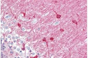 Anti-PACSIN1 antibody IHC staining of human brain, cerebellum. (PACSIN1 anticorps  (AA 2-15))