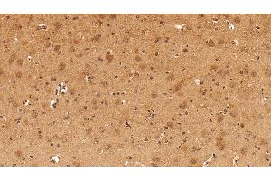 Detection of GAL8 in Rat Cerebrum Tissue using Polyclonal Antibody to Galectin 8 (GAL8)