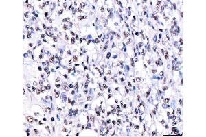 IHC analysis of CRTC3 using anti-CRTC3 antibody (ABIN7599779). (CRTC3 anticorps  (AA 116-619))
