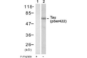 Image no. 1 for anti-Microtubule-Associated Protein tau (MAPT) (pSer422) antibody (ABIN319250) (MAPT anticorps  (pSer422))
