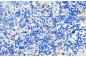 Immunohistochemistry of paraffin-embedded Mouse spleen using FLNA Polyclonal Antibody at dilution of 1:100 (40x lens). (Filamin A anticorps)