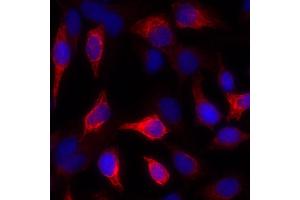 Immunofluorescence (IF) image for anti-Keratin 1 (KRT1) antibody (ABIN7449048) (Cytokeratin 1 anticorps)