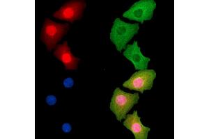 ABIN7095267 and ABIN7099324 staining Hela cells by IF/ICC.