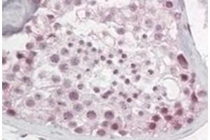 Image no. 2 for anti-Pescadillo Ribosomal Biogenesis Factor 1 (PES1) (N-Term) antibody (ABIN374331) (PES1 anticorps  (N-Term))