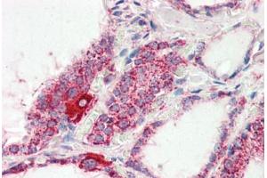Human Thyroid (formalin-fixed, paraffin-embedded) stained with COX4I1 antibody ABIN461950 at 2. (COX IV anticorps  (AA 154-166))