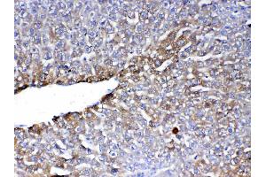 IHC analysis of PON1 using anti-PON1 antibody .
