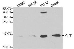 Western Blotting (WB) image for anti-Profilin 1 (PFN1) antibody (ABIN1874102) (PFN1 anticorps)
