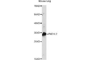 Western blot analysis of extracts of mouse lung, using PKD1L2 antibody. (PKD1L2 anticorps)