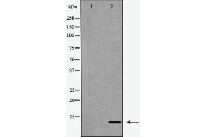 Western blot analysis of extracts from Jurkat cells, treated with serum (20%, 15mins), using CKS1 antibody. (CKS1 anticorps  (N-Term))