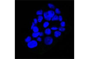 Confocal Immunofluorescent analysis of A431 cells using AF488-labeled Isotype Control MAb (IgG2a) (Green). (EGFR anticorps  (Extracellular Domain))