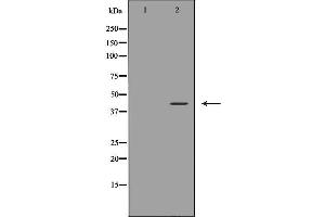 Western blot analysis of Jurkat cell extracts, using CD244 Antibody. (2B4 anticorps  (N-Term))