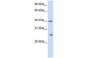 WB Suggested Anti-GSTK1 Antibody Titration: 0. (GSTK1 anticorps  (N-Term))