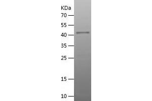 Western Blotting (WB) image for Lysosomal-Associated Membrane Protein 2 (LAMP2) (AA 34-231) protein (His-IF2DI Tag) (ABIN7123813) (LAMP2 Protein (AA 34-231) (His-IF2DI Tag))