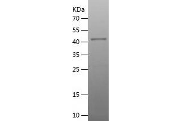 LAMP2 Protein (AA 34-231) (His-IF2DI Tag)