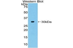 Western blot analysis of the recombinant protein. (ADCY2 anticorps  (AA 294-525))