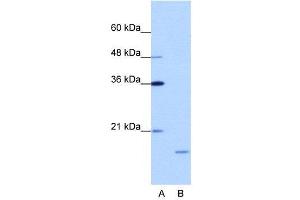 WB Suggested Anti-ISG20  Antibody Titration: 1. (ISG20 anticorps  (N-Term))