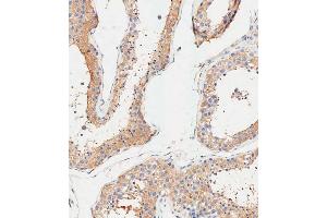 Immunohistochemical analysis of paraffin-embedded Human testis tissue using (ABIN1945086 and ABIN2838551) performed on the Leica® BOND RXm. (ALDH1A1 anticorps  (AA 306-339))