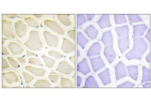 Immunohistochemistry analysis of paraffin-embedded human skeletal muscle tissue using COL10A1 antibody.