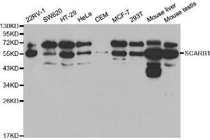 Western blot analysis of extracts of various cell lines, using SCARB1 antibody. (SCARB1 anticorps  (AA 1-100))