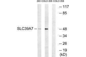 Western Blotting (WB) image for anti-Solute Carrier Family 39 (Zinc Transporter), Member 7 (SLC39A7) (Internal Region) antibody (ABIN1852426) (SLC39A7 anticorps  (Internal Region))