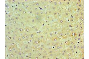 Immunohistochemistry of paraffin-embedded human liver tissue using ABIN7172247 at dilution of 1:100 (TRAF6 anticorps  (AA 1-522))