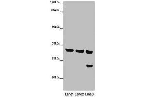 Western blot All lanes: SLC25A10 antibody at 16 μg/mL Lane 1: Mouse liver tissue Lane 2: Mouse kidney tissue Lane 3: HepG2 whole cell lysate Secondary Goat polyclonal to rabbit IgG at 1/10000 dilution Predicted band size: 32, 33 kDa Observed band size: 32, 24 kDa (Slc25a1 anticorps  (AA 124-162))