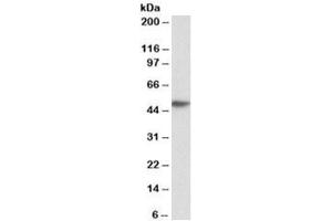 Western blot testing of human peripheral blood lymphocyte lysate with FCER1A antibody at 0. (Fc epsilon RI/FCER1A anticorps)
