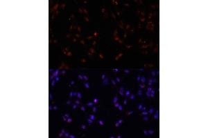 Immunofluorescence analysis of NIH-3T3 cells using ILF3 antibody (ABIN3023309, ABIN3023310, ABIN3023311 and ABIN6219571) at dilution of 1:100. (Interleukin enhancer-binding factor 3 (ILF3) (AA 1-270) anticorps)