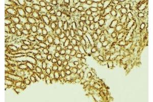 ABIN6276597 at 1/100 staining Mouse kidney tissue by IHC-P. (FHIT anticorps  (Internal Region))