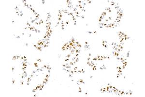 Immunocytochemistry (ICC) image for anti-Sp1 Transcription Factor (SP1) (AA 250-300) antibody (ABIN7795788)