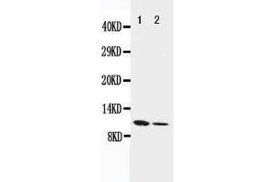 Anti-Resistin antibody, Western blotting Lane 1: Recombinant Mouse Resistin Protein 10ng Lane 2: Recombinant Mouse Resistin Protein 5ng (Resistin anticorps  (C-Term))