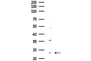 Western blot analysis of lysates from PC12 cells(LPS 4h treatment), using TCEAL5 Antibody at 1/1000 dilution.