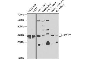 Western blot analysis of extracts of various cell lines, using SPIN2B antibody  at 1:1000 dilution. (Spindlin 2B anticorps  (AA 1-258))