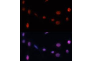 Immunofluorescence analysis of NIH/3T3 cells using CDKN1A/p21CIP1 antibody (ABIN3022005, ABIN3022006, ABIN3022007 and ABIN6218565) at dilution of 1:100.