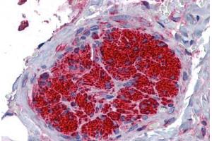 anti-Sarcoglycan, beta (43kDa Dystrophin-Associated Glycoprotein) (SGCB) (AA 87-197) antibody