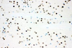 IHC analysis of Ataxin 1 using anti-Ataxin 1 antibody (ABIN3043506). (Ataxin 1 anticorps  (C-Term))