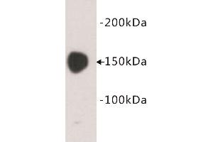Western Blotting (WB) image for anti-Carcinoembryonic Antigen Gene Family (CEA) antibody (ABIN1854846) (CEA anticorps)