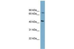 Image no. 1 for anti-Frizzled Family Receptor 6 (FZD6) (AA 539-588) antibody (ABIN6743054) (FZD6 anticorps  (AA 539-588))